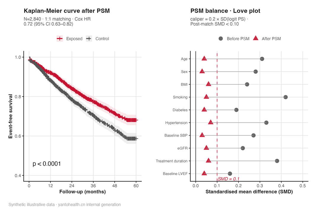 Illustrative Kaplan-Meier curves and Love plot: event-free survival curves for two propensity-score-matched groups on the left; standardised mean differences for each covariate before and after matching on the right.